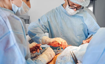 laparoscopic hysterectomy