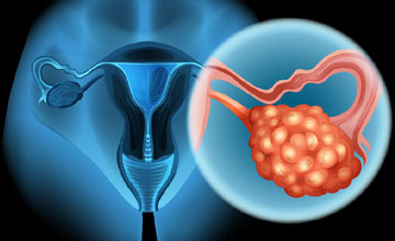 gynecological cancer surger