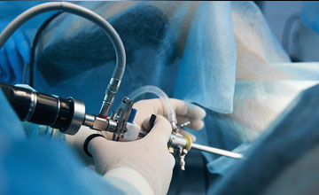 hysteroscopic surgery