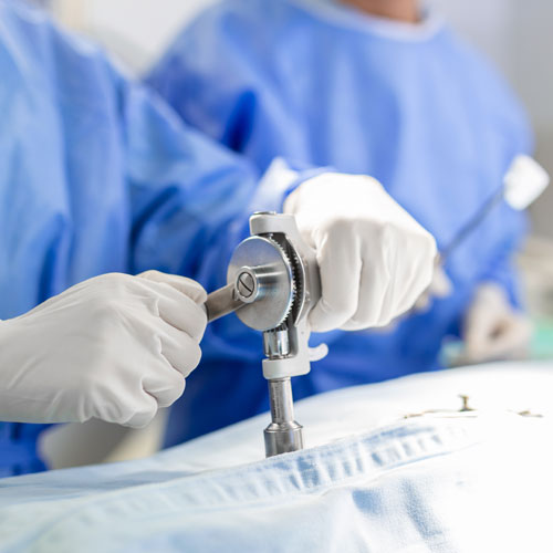 gynecological endoscopy