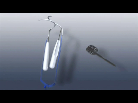 urinary incontinence - 1 - TVT needles with tape